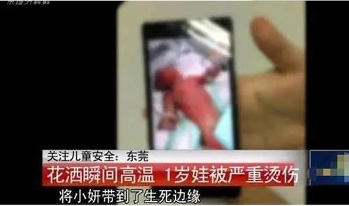 伤口|孩子烫伤后只有2分钟紧急处理,做错这一步,可能加重孩子的伤情