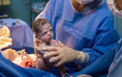 眼神|巴西“臭脸女婴”火了,眼神中充满“杀气”,网友:这娃有起床气