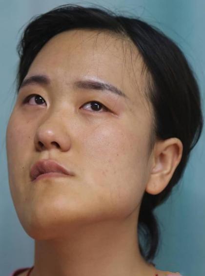 整容 歪脸女孩整容逆袭成女神,舍百万年薪当老师,这才是整容的意义