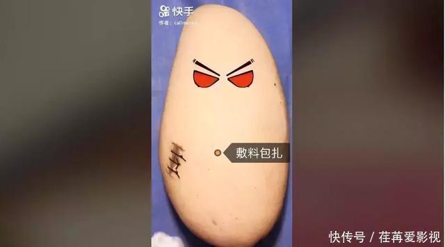 王醫生|32歲醫生竟給水果做手術？一夜吸粉12萬！網友：“我的膝蓋跪爛了”