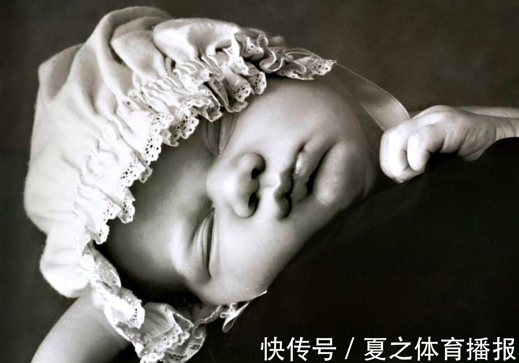 脖子|宝宝身体这些部位有痣,是“有福气”的信号,看看你家娃中了没?