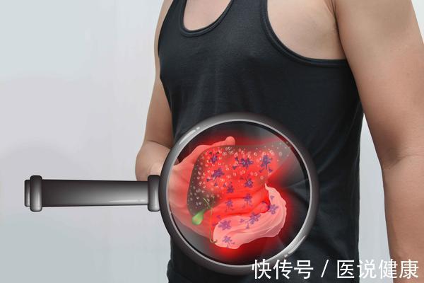 肝功能|肝不好,脸先知!医生:脸上若有这3个特征,或是肝脏癌变的信号