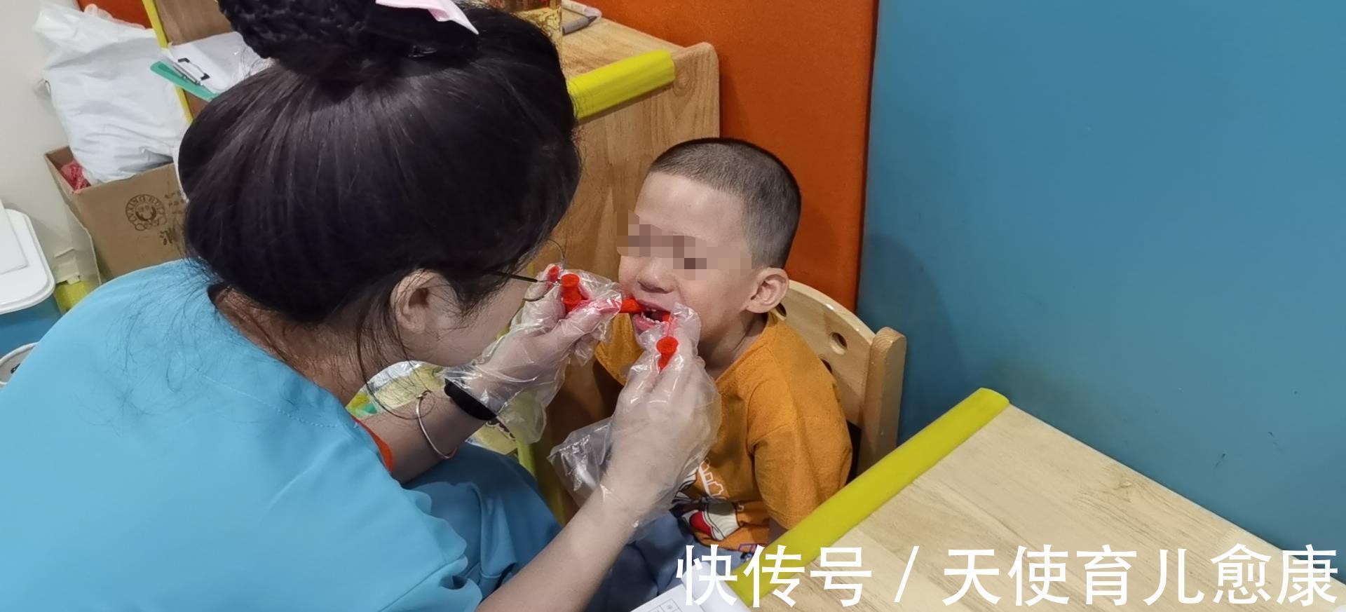 训练|天使科普：揭开“口肌训练”的神秘面纱，它究竟是什么？