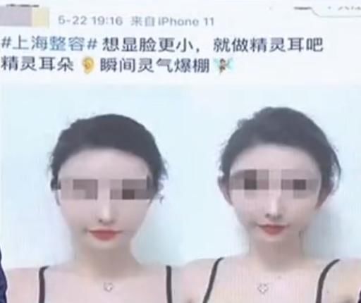 整形|多家整形机构推“精灵耳”变美？专家：或整成畸形