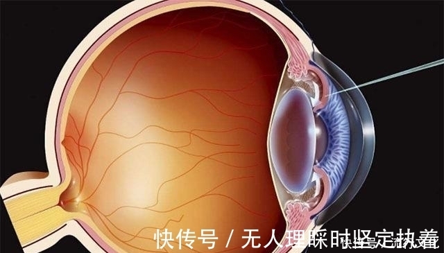 视力|血糖高的人,脸上若没有这4个“变化”, 恭喜你!状态可能还不错