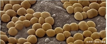 8岁小孩出去玩，回家不洗手按了个手印，妈妈培养48小时后