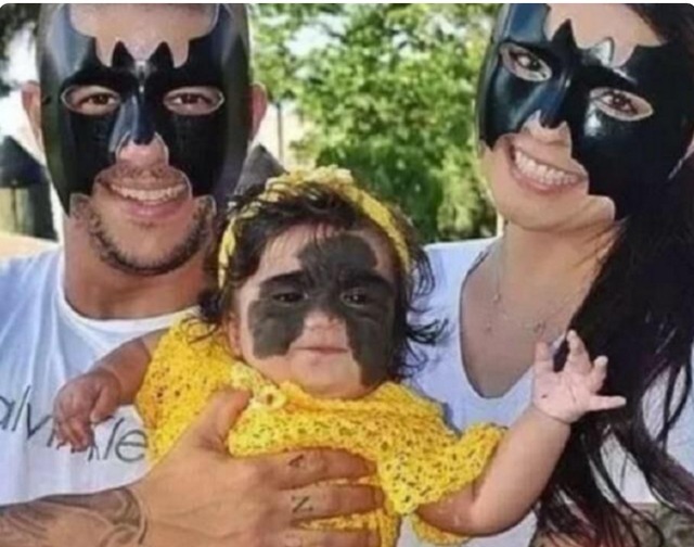 整容|“蝙蝠侠宝宝”火了,美国夫妇将她送去整容祛除胎记,后来怎么样