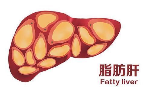 阶段|医生不隐瞒:肝癌发展期需经历4个阶段,把握时机,有利控制病情