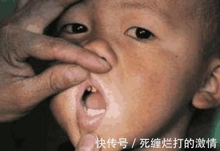 医院|男孩因口臭被孤立,爸爸带到医院去检查,张嘴后医生都吐了