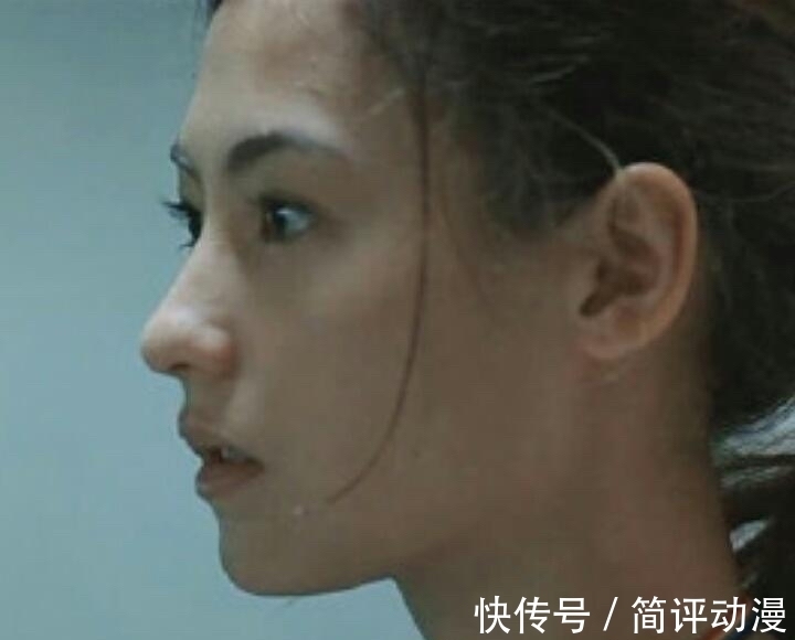 鼻唇沟|鼻基底凹陷怎么办?