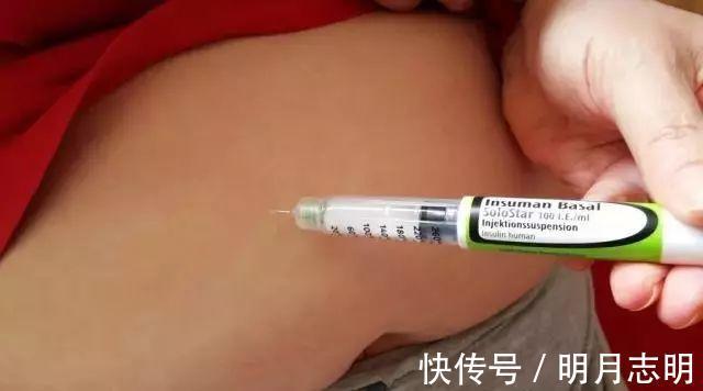 大肚子|中年女子要减掉大肚子真的很简单,用这些方法就行了