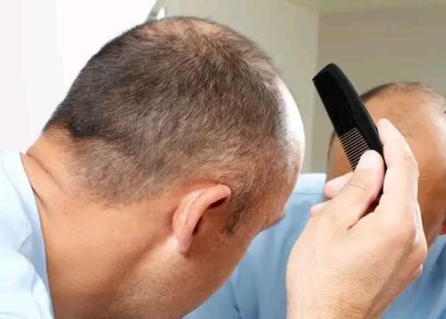 男人初老的5個癥狀，你中了幾個？若一個都沒有，真是好兆頭