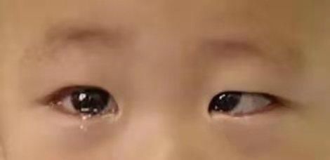 凶手|6岁男孩黑眼球逐渐消失,“凶手”竟然是每天都会用到的“玩具”