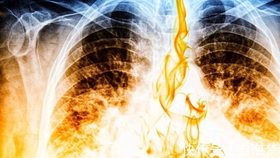 下降|已发现癌症死亡率在下降,但不是所有类型,说明有个因素在起作用