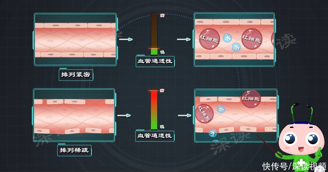 通透性|从腿上小红疹到血尿、蛋白尿，过敏性紫癜是咋搞出肾损伤的？