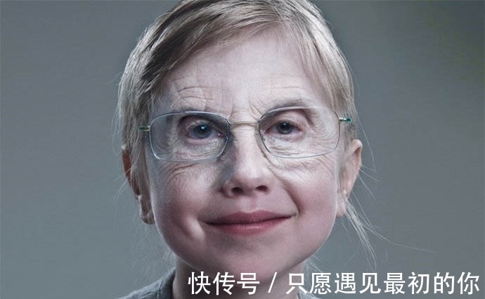 奇葩|国外奇葩婴儿“返老还童”,一出生如同80岁老头,父母不惊反喜!