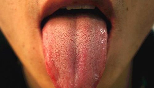 口臭不敢张嘴试试去口臭小妙方,快速清新