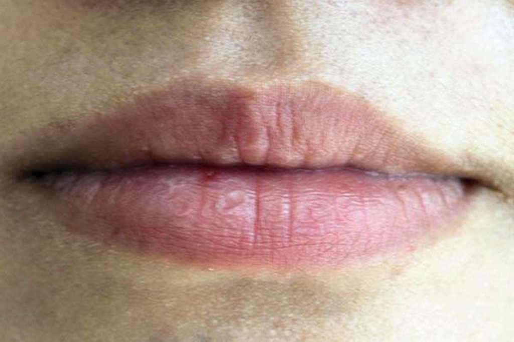 女性|女人有妇科病,嘴巴常会有几种表现暗示你,希望你一个都没有