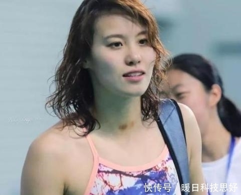 整容|中国体坛“洪荒之力”整容?傅园慧整牙后颜值瞬间逆天