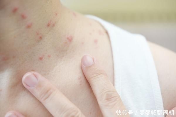 半个月|被褥半个月不换洗，螨虫上“百万”，教你除螨方法，减少危害