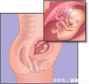 怀孕胎儿位置在前壁后壁有什么不同吗?