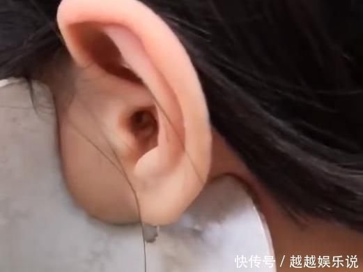 棉花棒|粗心妈妈以为孩子反应迟钝原来是耳垢填满耳朵,导致孩子听不到