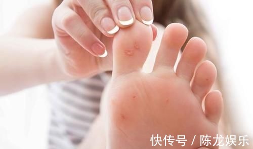 糖尿病|糖尿病足来临时,脚部4个变化“藏不住”,糖友们,需留心观察