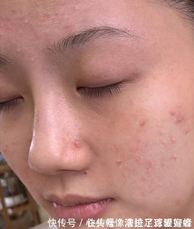 护肤品 脸上出现这4点“征兆”,说明你该好好护肤了,很多人都有!