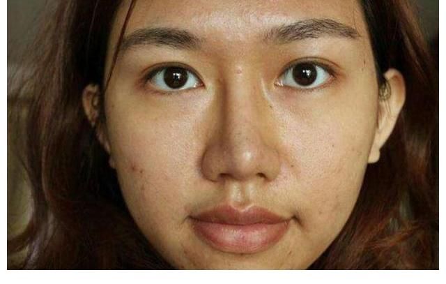 黄褐斑|皮肤的天然“去黄剂”被找到,若爱吃,消除黑色素,养颜补气血