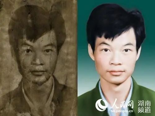 一张照片让失散姐弟重聚！这项“手术”不一般