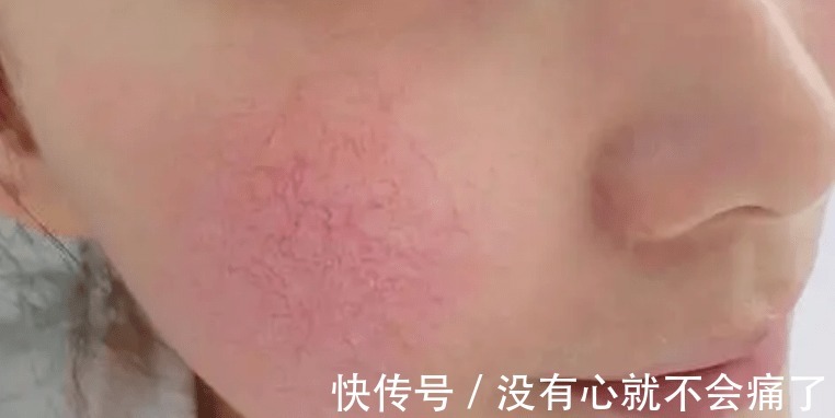 敏感肌 柔肤水、爽肤水、精华水、化妆水的区别是什么?怎么选择护肤水?