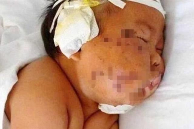 男婴|还记得4年前那个被妈妈拿剪刀划成“花脸猫”的男婴吗?现在长成了这样