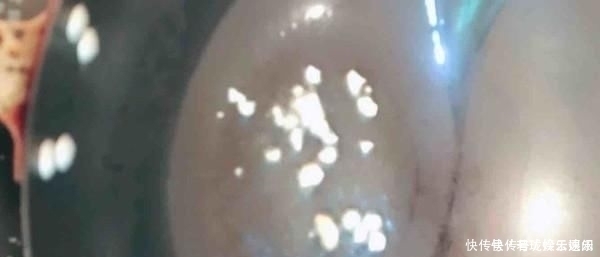 真正的“刮油王”是它,隔天吃一些,清早排出