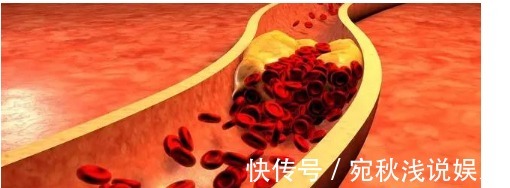 辟謠|降壓藥降脂藥吃著就沒事了？辟謠：血壓血脂達標，沒有副作用