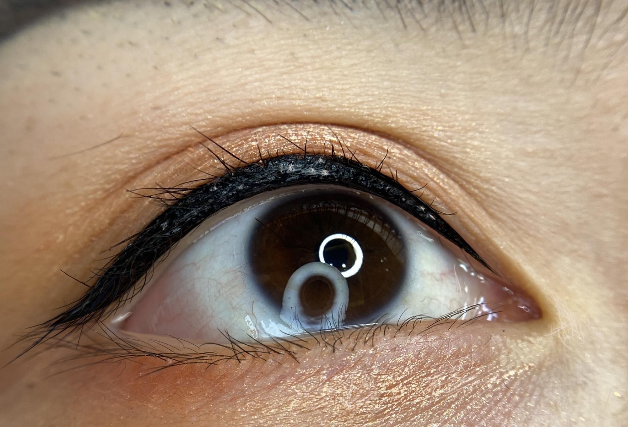 美瞳线常见操作答疑，有这些情况不能操作美瞳线