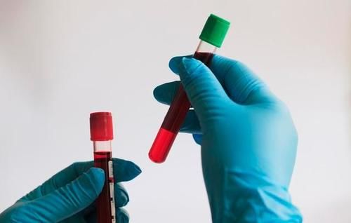  保护好肾功能，不能只看血肌酐，别忽视了这3项指标的稳定