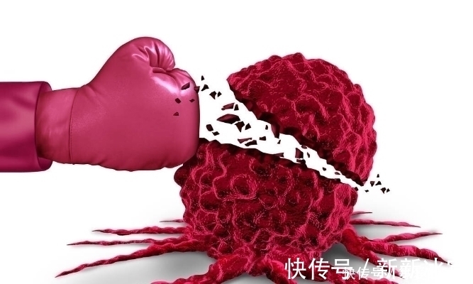 大部分|患癌就等于死亡?错!大部分的早期癌症,都有治愈的可能