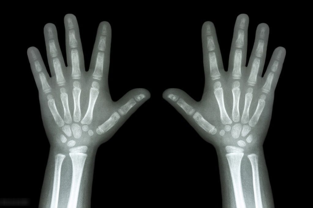 身高|天天喝牛奶吃钙片,孩子还是不长个子?孩子身高每年长多少正常?