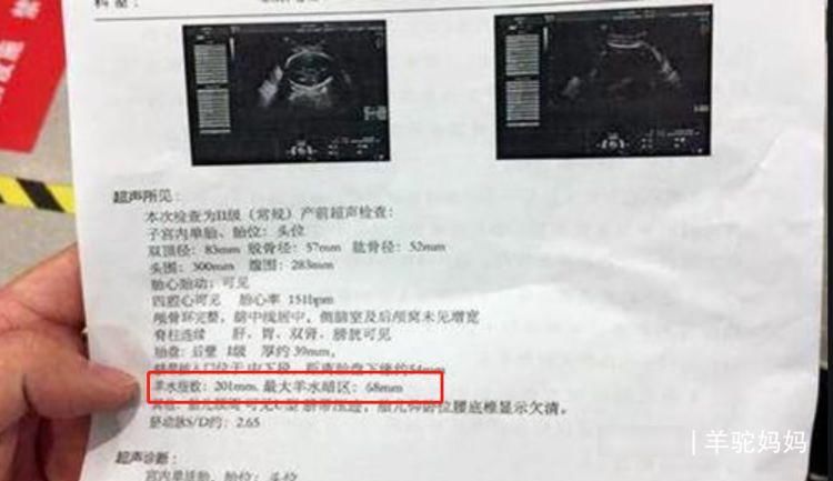 分娩|临近分娩羊水多少合格？产妇要注意产检单上这数字，早了解早受益