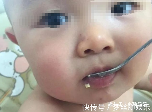 辅食|为何不能给宝宝吃“鸡蛋羹”儿科医生劝诫多次,家长要听进去