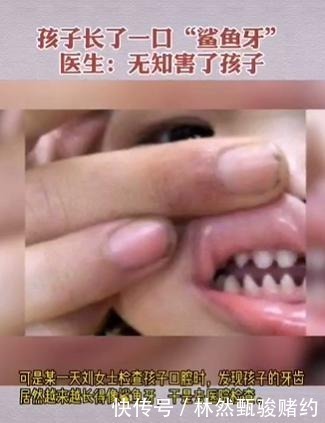 牙齿|3岁娃一口''鲨鱼牙'',妈妈还夸咬东西锋利,医生无知害了孩子