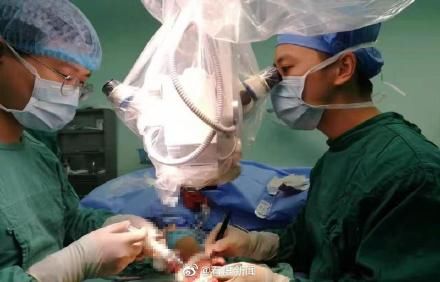 男子|男子断掌超24小时再植成功 手术超6小时