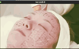 超声提升 热玛吉&超声提升,谁是抗衰NO.1?抗衰选它就对了!