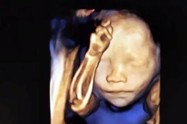 四维|孕期胎儿的四维图像，就是出生时候的模样？别急，后面可能有惊喜