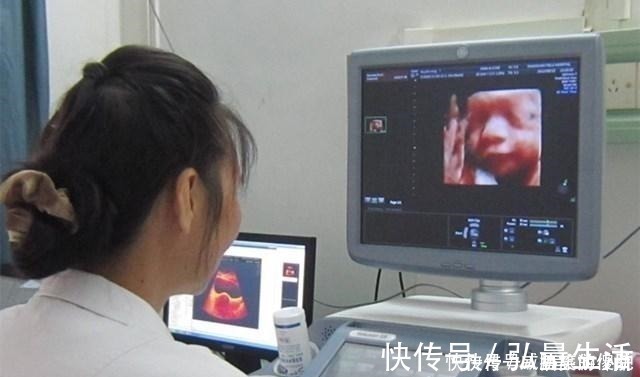 孕妇|怀孕8个月查出畸形,医生建议引产,孕妈纠结到底该留还是“流”