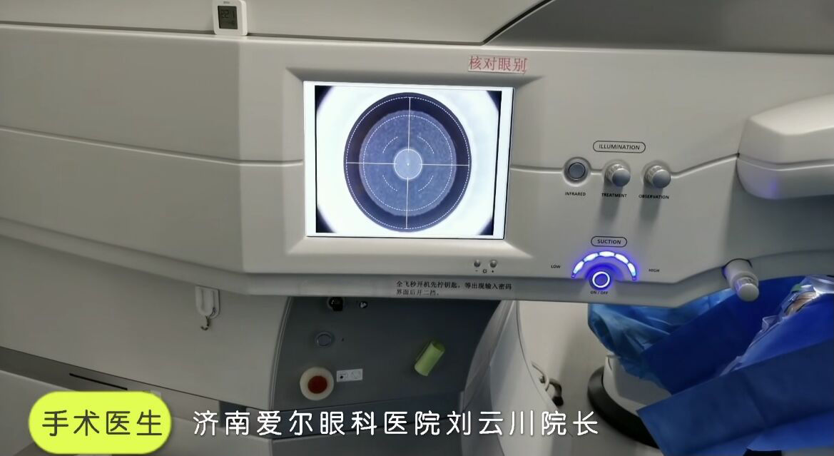 激光打眼那些事儿,近视手术里的“减法手术”|专访济南爱尔眼科刘云川 | 近视手术