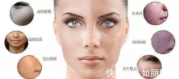 如果爱 深扒!超光子和光子嫩肤的区别,你更适合哪一种呢?