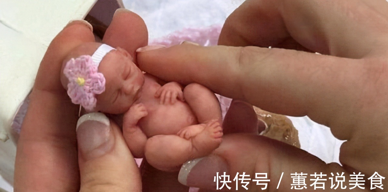 磨难|生命奇迹!“世界最小婴儿”出生仅25厘米,如今18岁的她怎样了