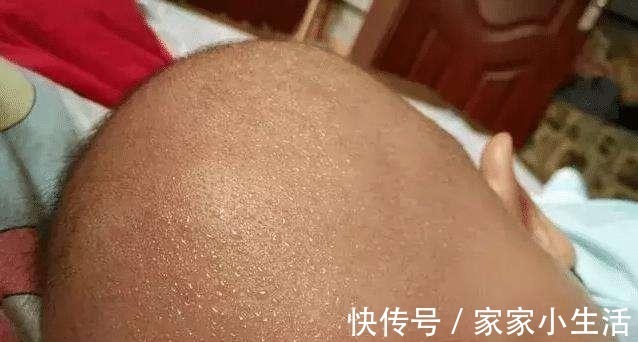 散热|【家家母婴】宝宝睡觉时总是满头大汗,是缺钙还是生病了?