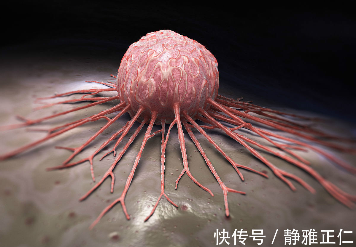 致癌物|癌细胞最钟爱五种食物,最后一种开水都煮不死,现在远离还不晚